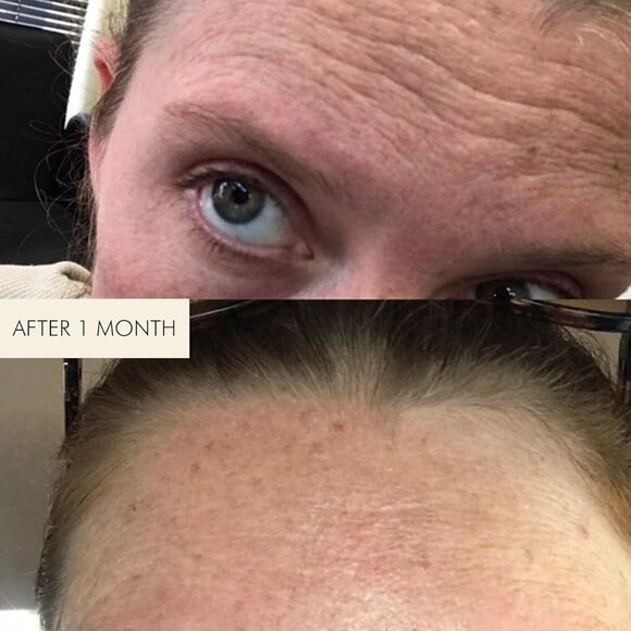 MARA - Natural Evening Primrose + Green Tea Algae Retinol Face Oil 15ml - Picture 3 of 6